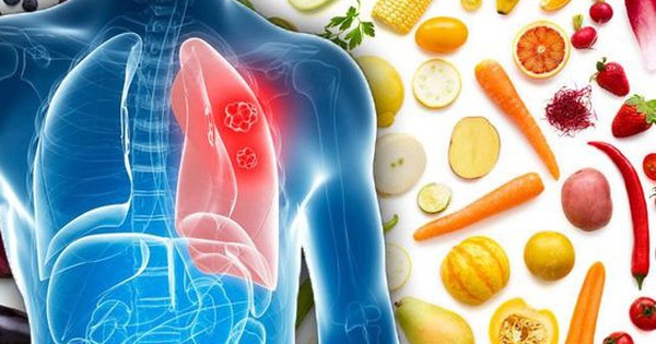 Thực phẩm ngừa ung thư phổi