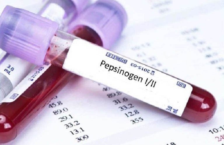 Định lượng Pepsinogen trong sàng lọc ung thư dạ dày không xâm lấn