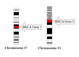 Ý nghĩa của đột biến gen BRCA1, BRCA2 trong bệnh ung thư vú di truyền