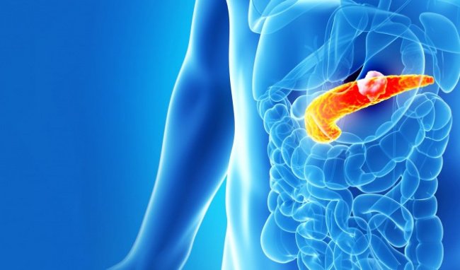 Hiểu biết cơ bản về ung thư tụy: Thông tin dành cho người bệnh