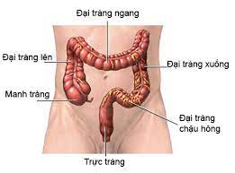 Các dấu hiệu sớm của ung thư trực tràng