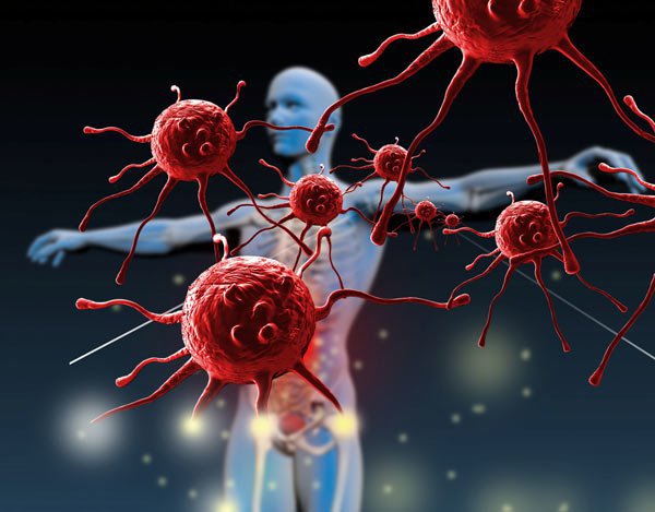 Vai trò của hệ miễn dịch trong việc kìm hãm sự phát triển của tế bào ung thư