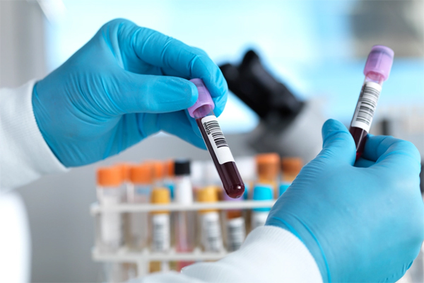 Các xét nghiệm máu được sử dụng trong chẩn đoán ung thư