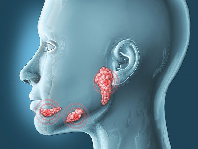 Chăm sóc răng miệng trong xạ trị ung thư vùng đầu cổ