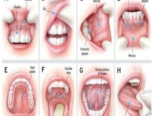 Cách giảm nguy cơ ung thư miệng