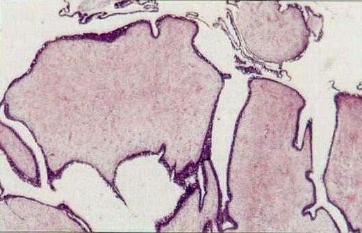 U phyllode là gì?